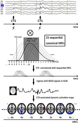 Antiepileptic Drug of Levetiracetam Decreases Centrotemporal Spike-Associated Activation in Rolandic Epilepsy